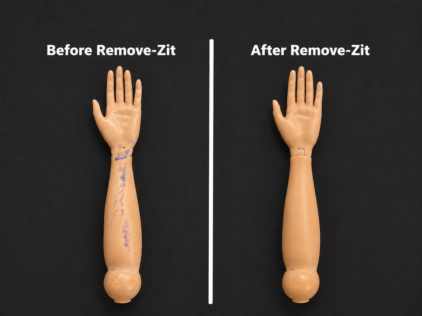 Remove-Zit